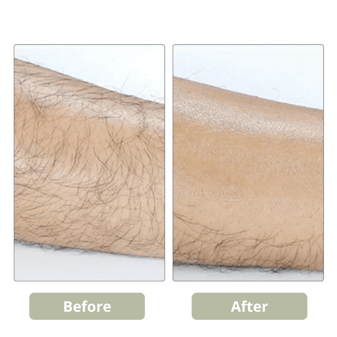 GET SMOOTH PAINLESS! - CRYSTAL HAIR ERASER