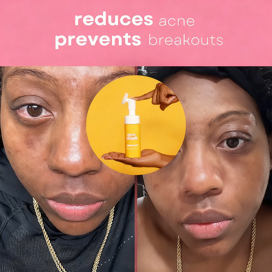VIRAL Turmeric & Kojic Acid Glow Wash