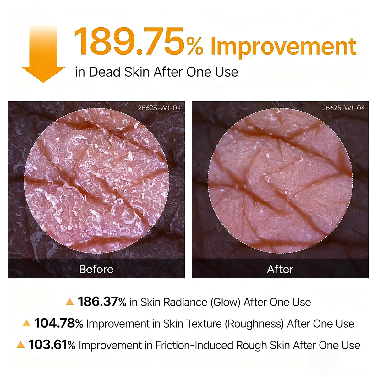 🌸 New! Peeling Shot Keratin Care Kojic Acid Turmeric Spray