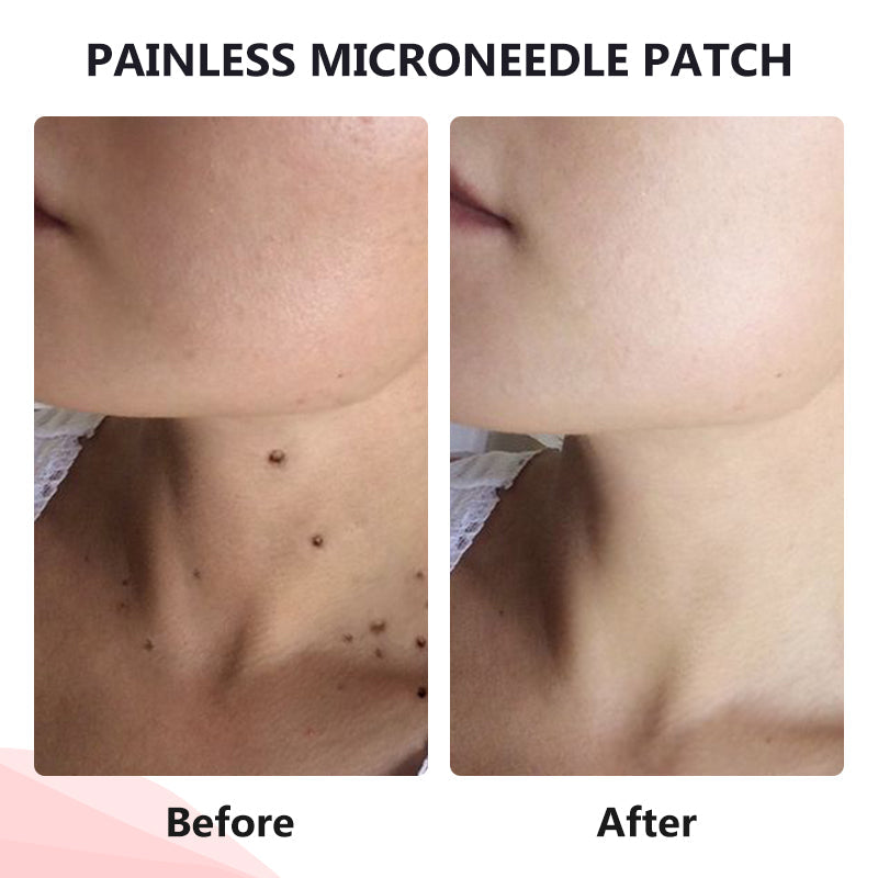 💥painless micro-patch🔥