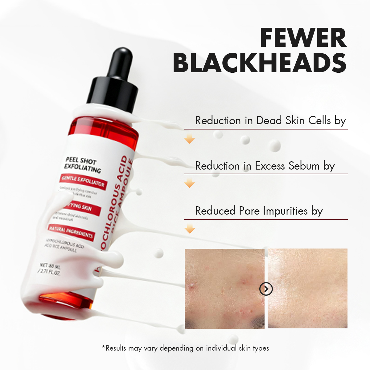 Hypochlorous Glow Duo – Gentle Exfoliation that Brightens & Clears Texture (Face + Body)