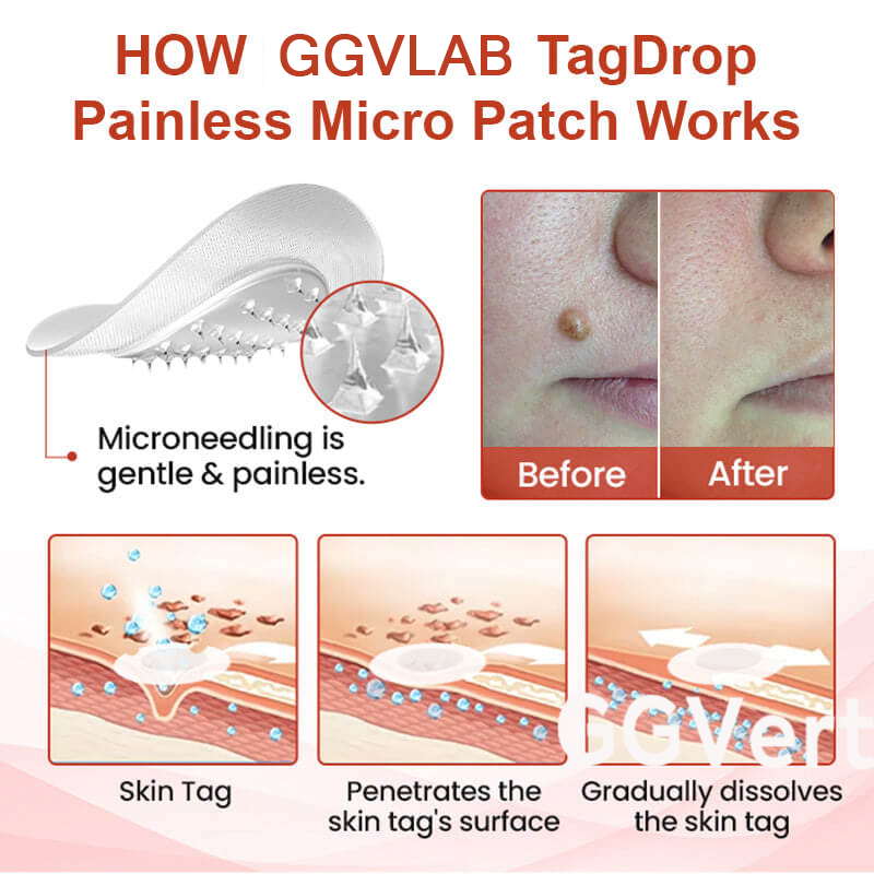 💥painless micro-patch🔥