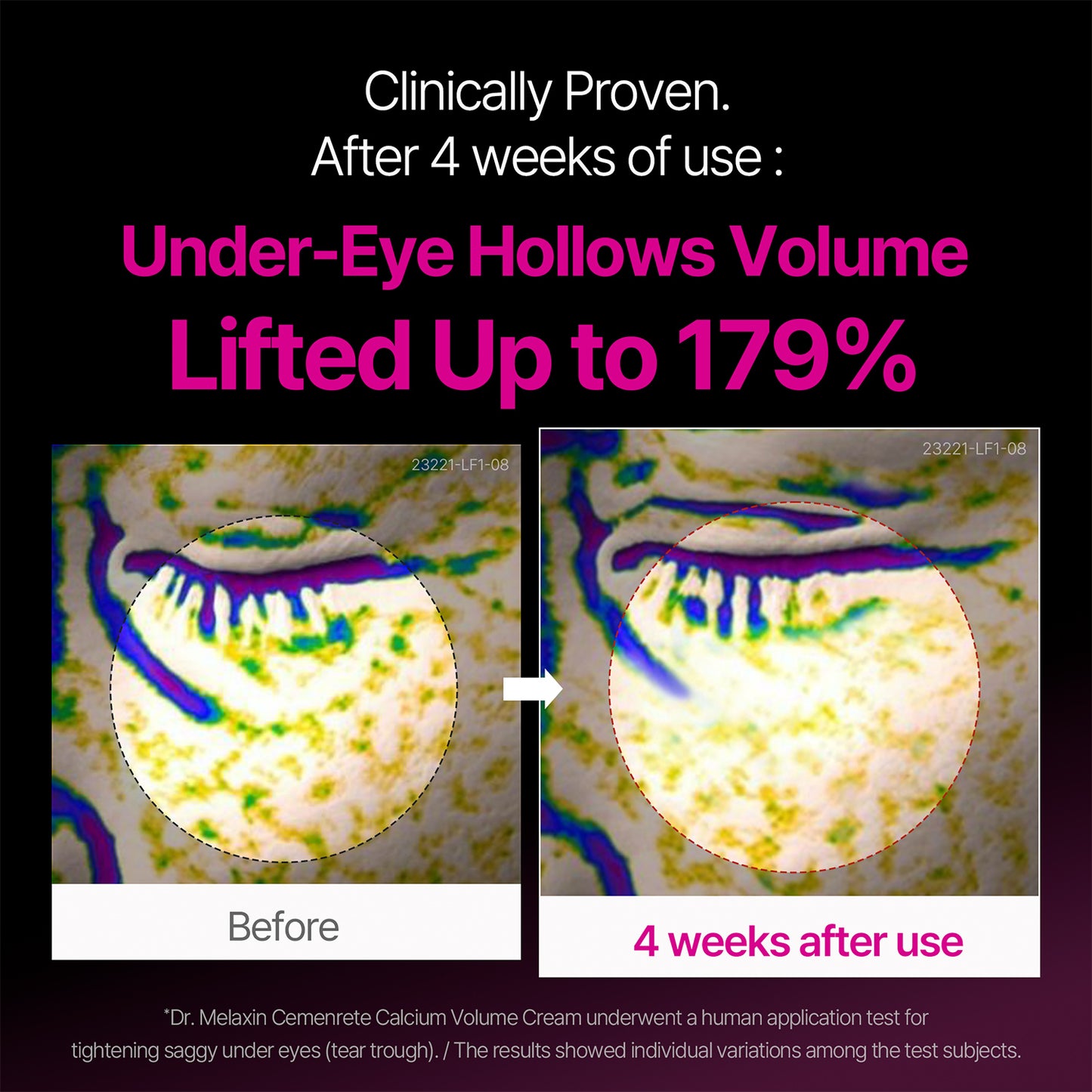 Brightening Eye Cream for Dark Circles