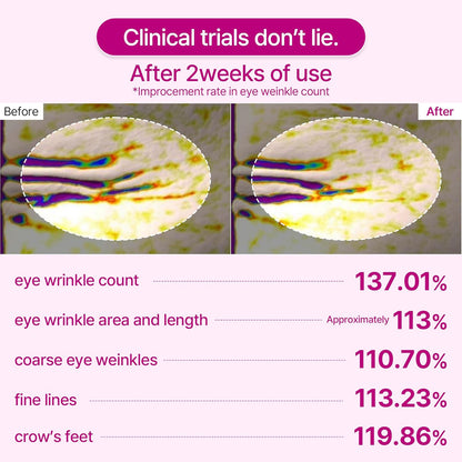 Brightening Eye Cream for Dark Circles