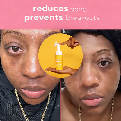 VIRAL Turmeric & Kojic Acid Glow Wash