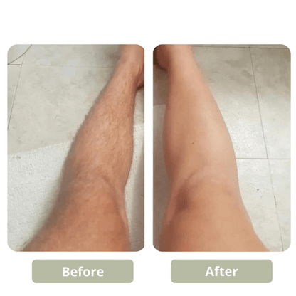 GET SMOOTH PAINLESS! - CRYSTAL HAIR ERASER