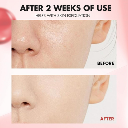 Hypochlorous Glow Duo – Gentle Exfoliation that Brightens & Clears Texture (Face + Body)