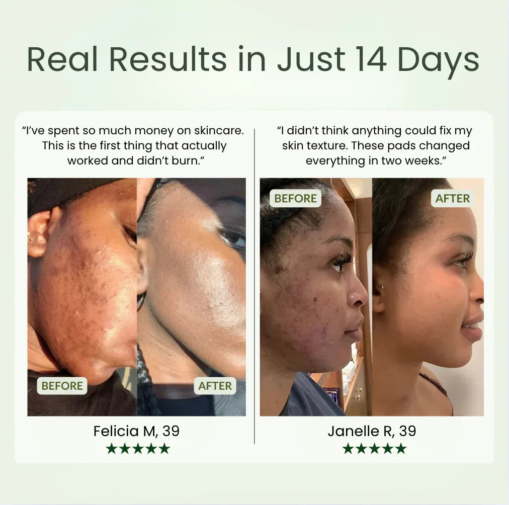 Korean Anti-Aging Toner Pads