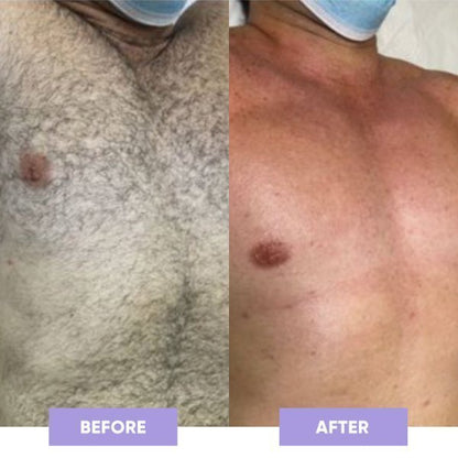 GET SMOOTH PAINLESS! - CRYSTAL HAIR ERASER